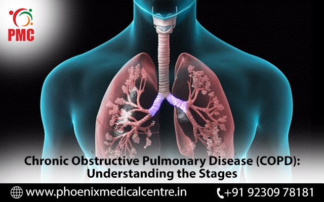 pulmonology specialist