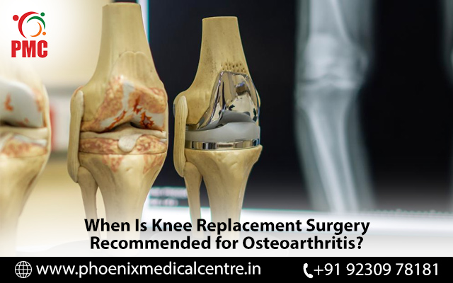 knee replacement