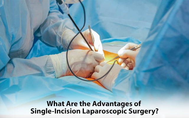 laparoscopic surgery advantages
